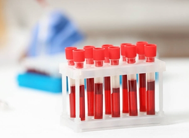 Transport of blood samples